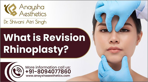 Rhinoplasty Surgery in Delhi – How to Get the Perfect Nose