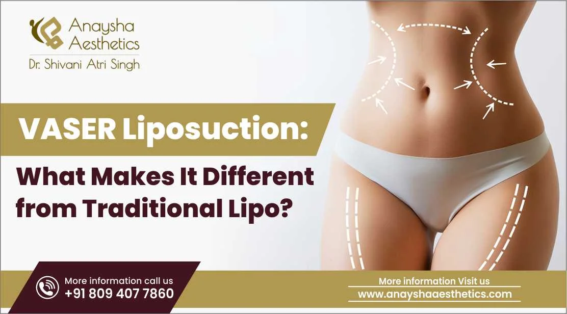 labiaplasty